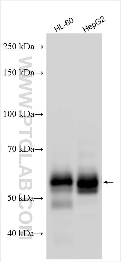 ZFP36L2