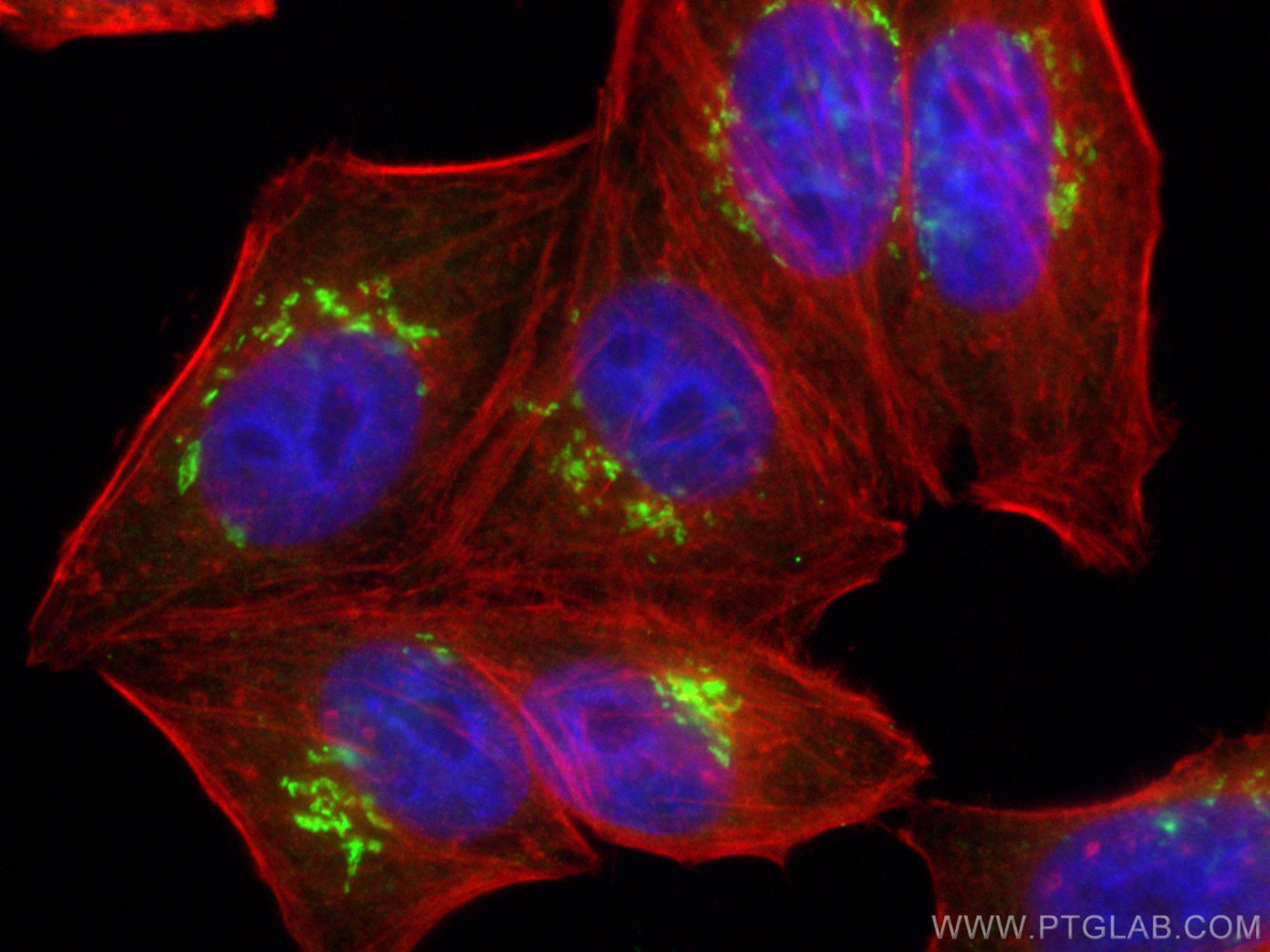 IF Staining of HepG2 using 27157-1-AP