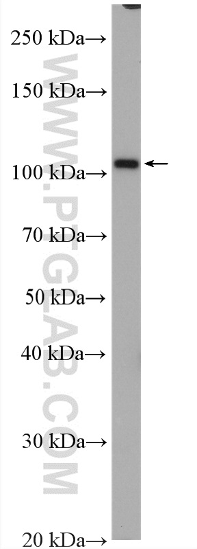 WB analysis of mouse liver using 28012-1-AP