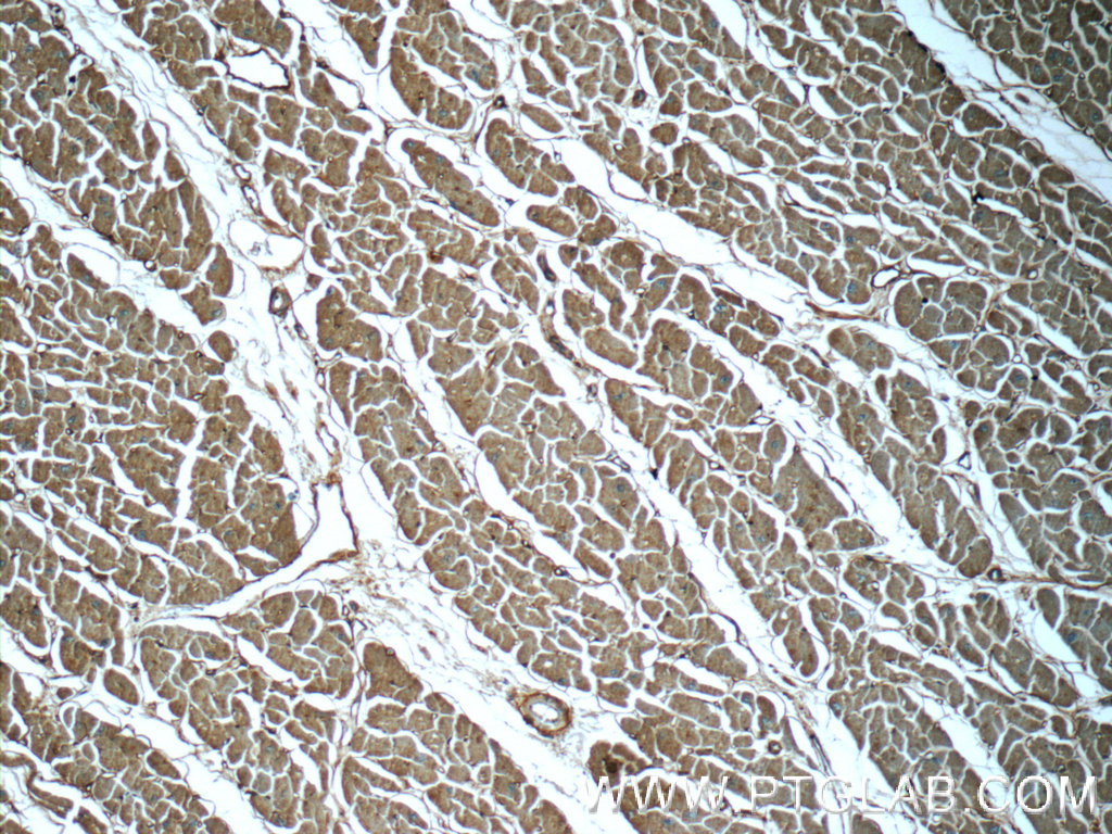 IHC staining of human heart using 23174-1-AP (same clone as 23174-1-PBS)