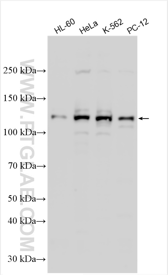 WB analysis using 27655-1-AP