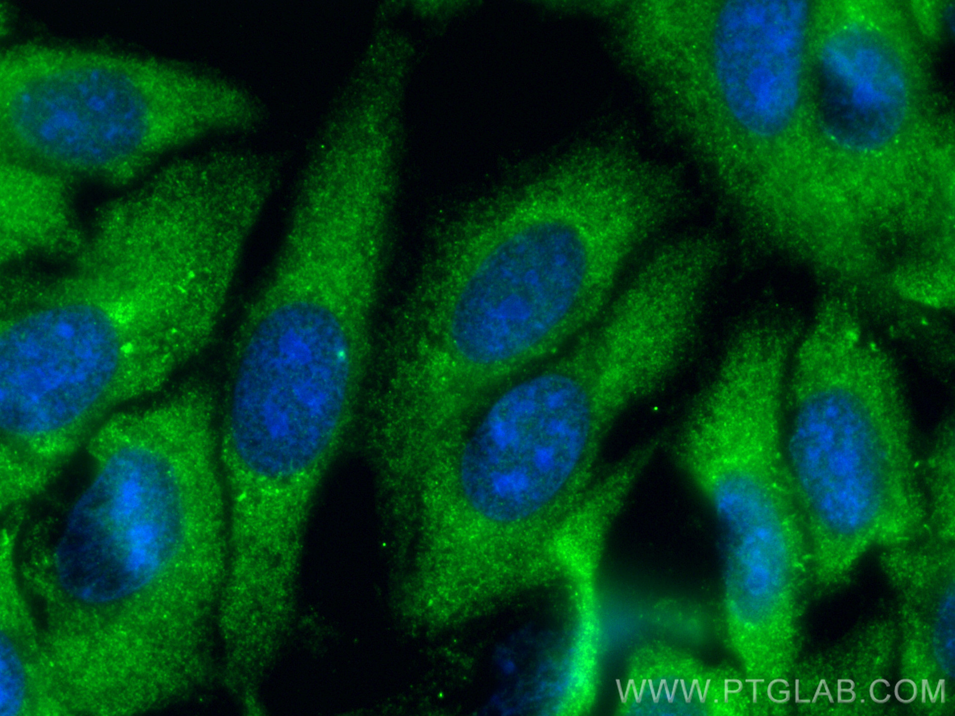 IF Staining of HepG2 using 25360-1-AP