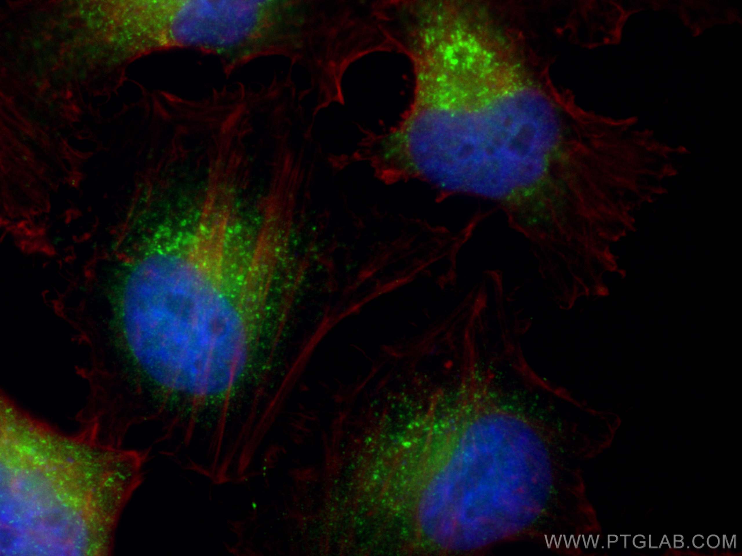 IF Staining of HeLa using 25360-1-AP