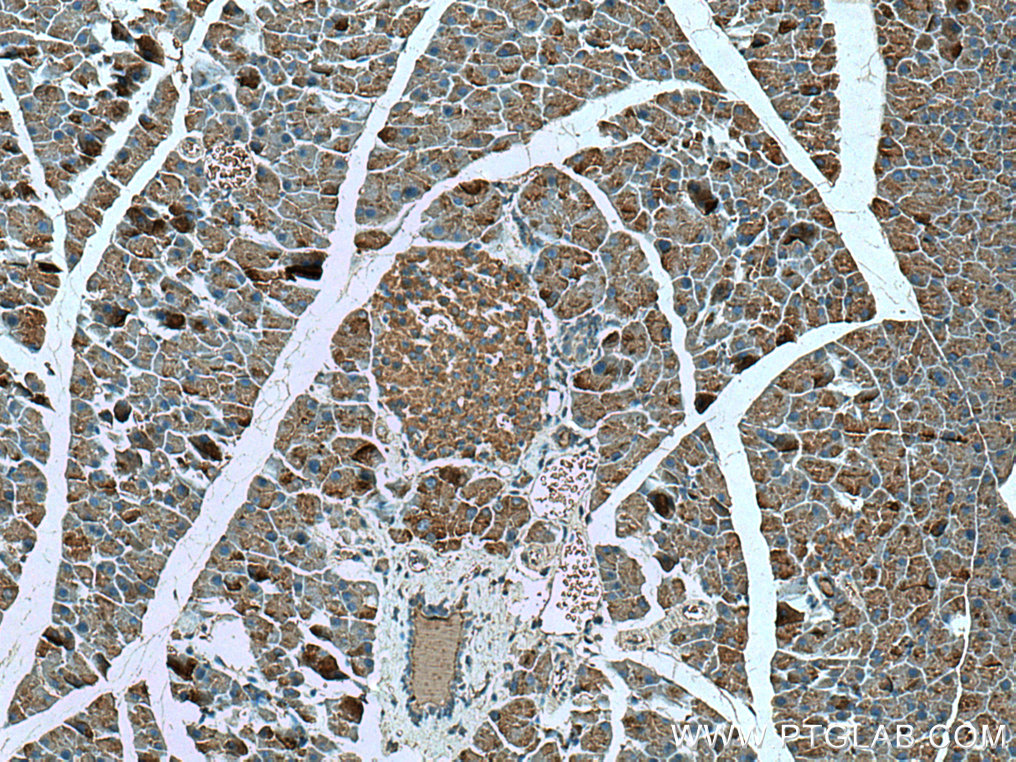 IHC staining of mouse pancreas using 67389-1-Ig (same clone as 67389-1-PBS)