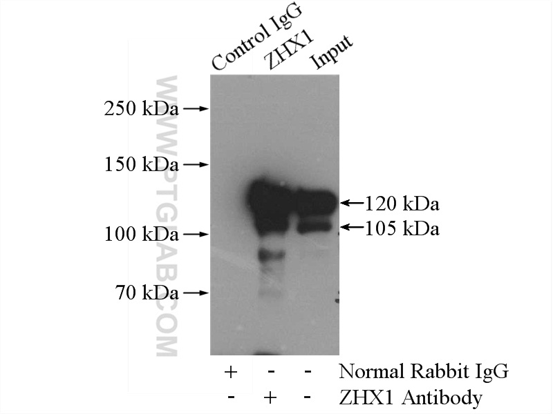 IP experiment of HEK-293 using 13903-1-AP