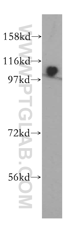 WB analysis of HeLa using 13903-1-AP