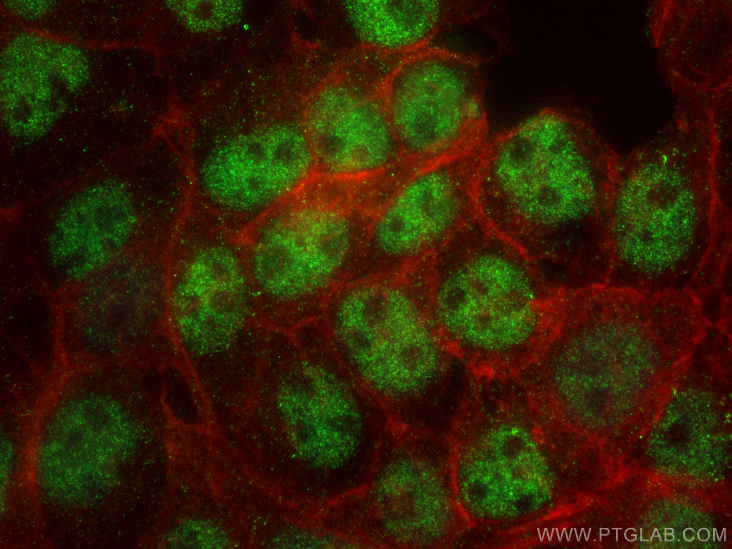 IF Staining of A431 using 68268-1-Ig