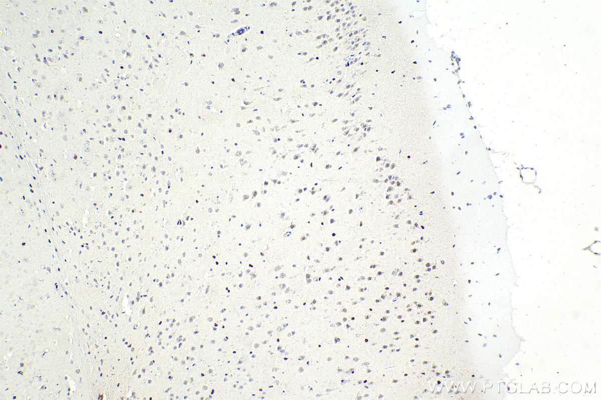 IHC staining of mouse brain using 68268-1-Ig (same clone as 68268-1-PBS)