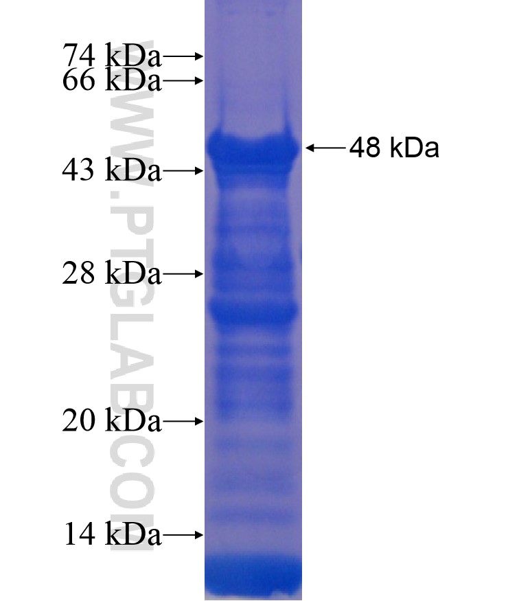 ZIC1 fusion protein Ag13400 SDS-PAGE