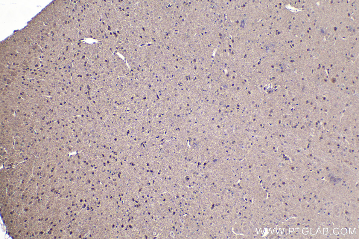 IHC staining of mouse brain using 21717-1-AP