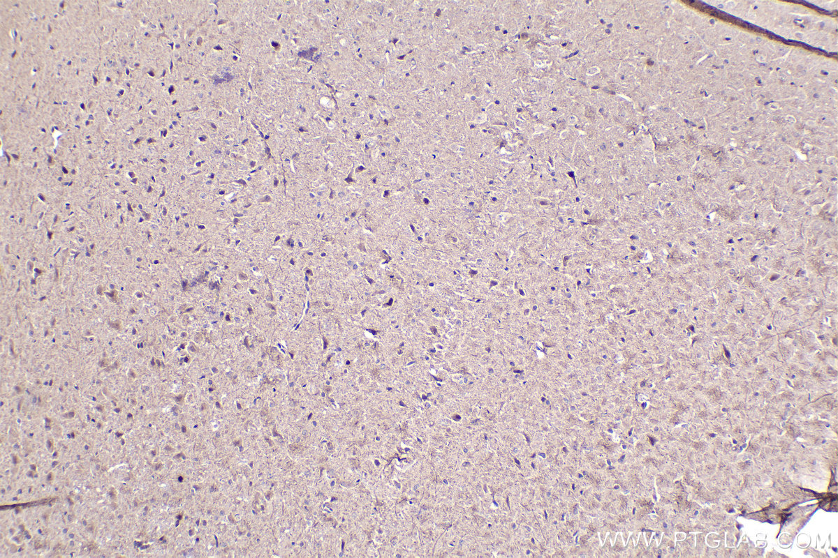 IHC staining of rat brain using 21717-1-AP