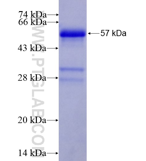 ZKSCAN3 fusion protein Ag14715 SDS-PAGE