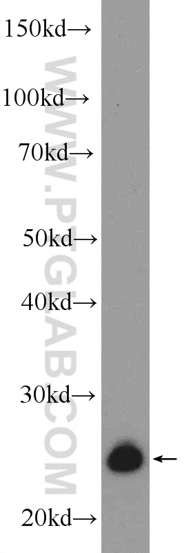 WB analysis of SH-SY5Y using 25819-1-AP