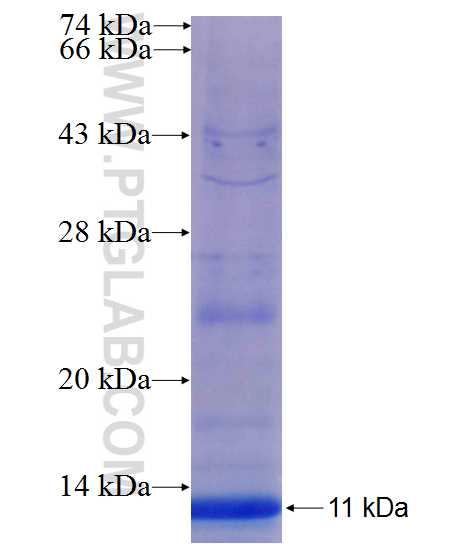 ZMAT4 fusion protein Ag21361 SDS-PAGE