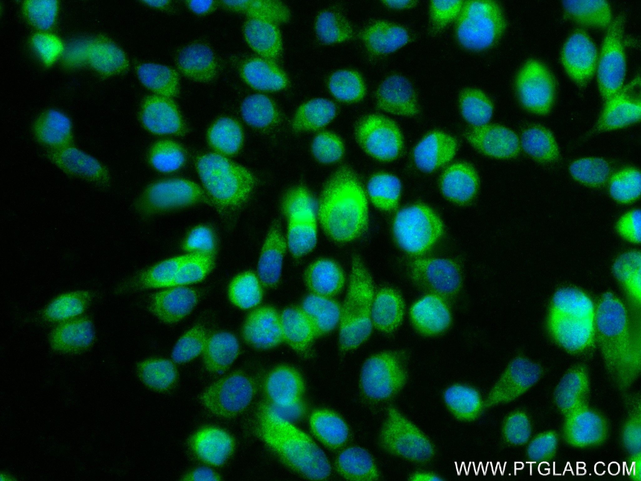 IF Staining of PC-3 using 84547-2-RR (same clone as 84547-2-PBS)