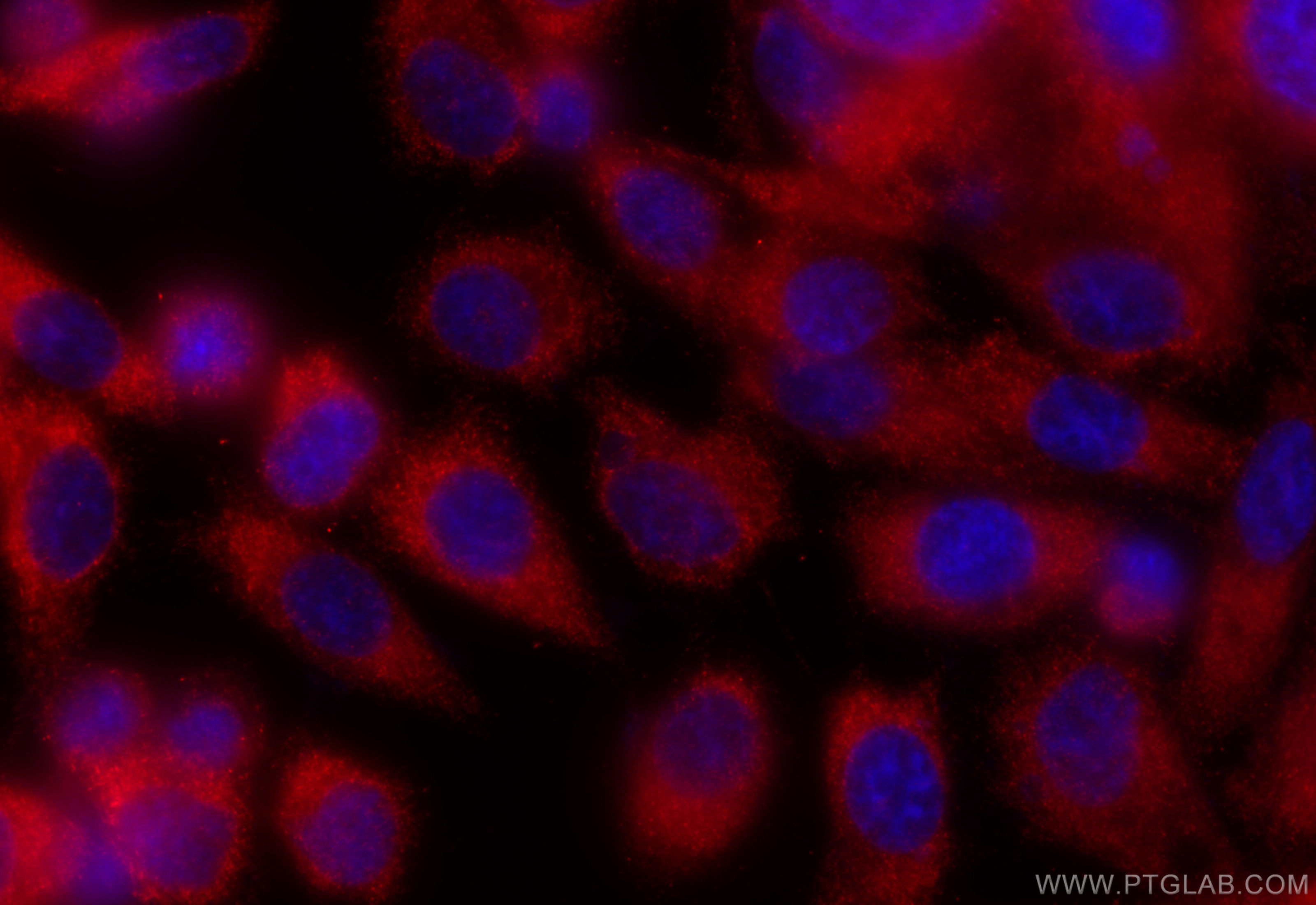 IF Staining of PC-3 using 84547-2-RR (same clone as 84547-2-PBS)