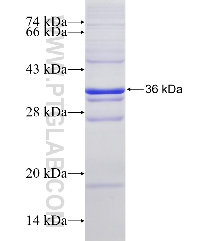 ZMPSTE24 fusion protein Ag3949 SDS-PAGE