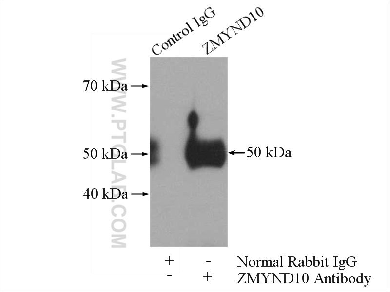 IP experiment of SH-SY5Y using 14431-1-AP