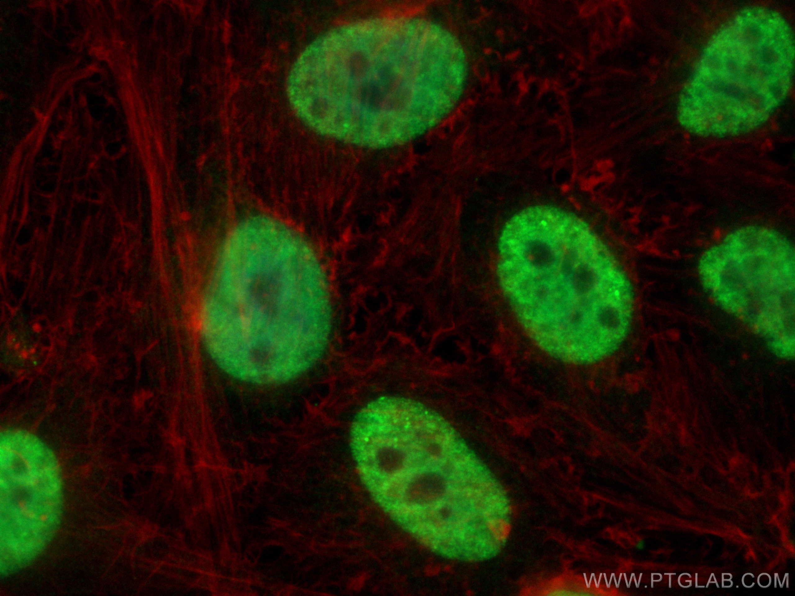 IF Staining of HeLa using 25599-1-AP