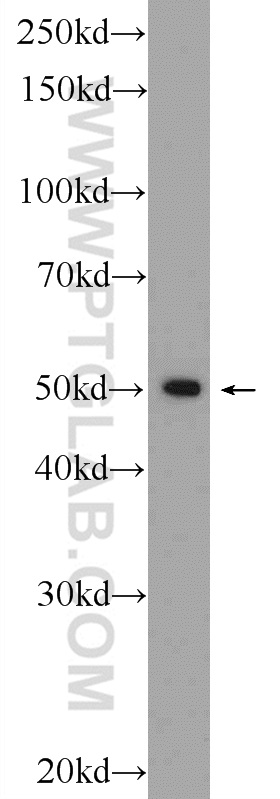 WB analysis of HepG2 using 25599-1-AP