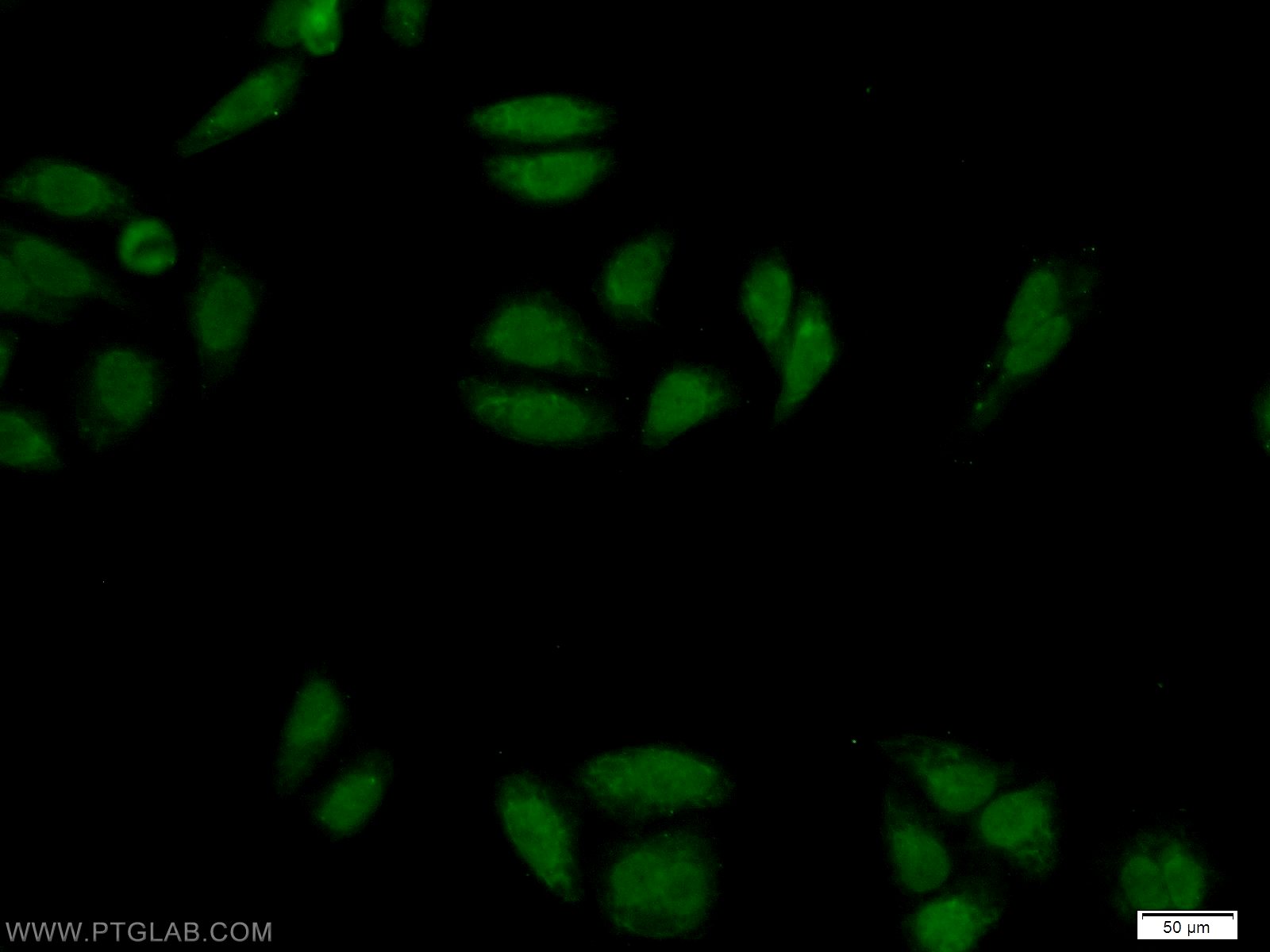 IF Staining of HepG2 using 25216-1-AP