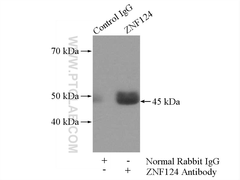 IP experiment of SH-SY5Y using 25216-1-AP