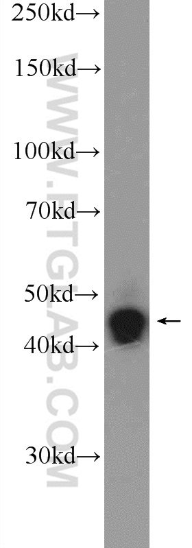 WB analysis of SH-SY5Y using 25216-1-AP