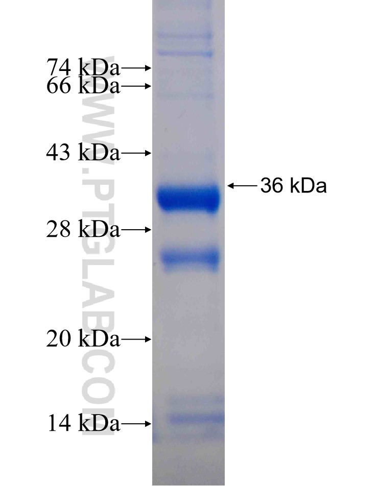 ZNF124 fusion protein Ag17165 SDS-PAGE