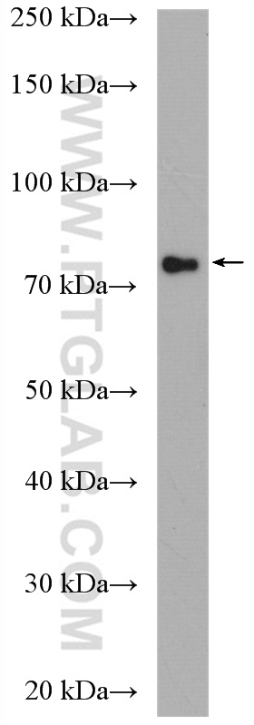 WB analysis of mouse heart using 21681-1-AP