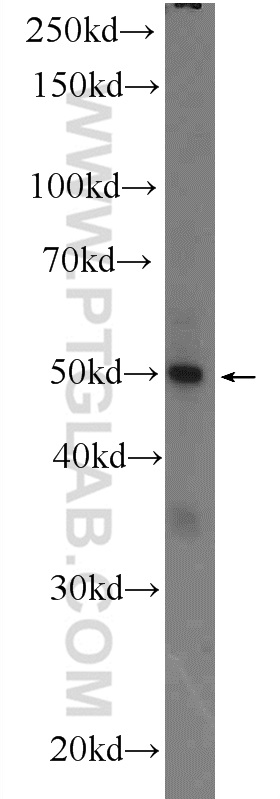 WB analysis of MCF-7 using 25515-1-AP