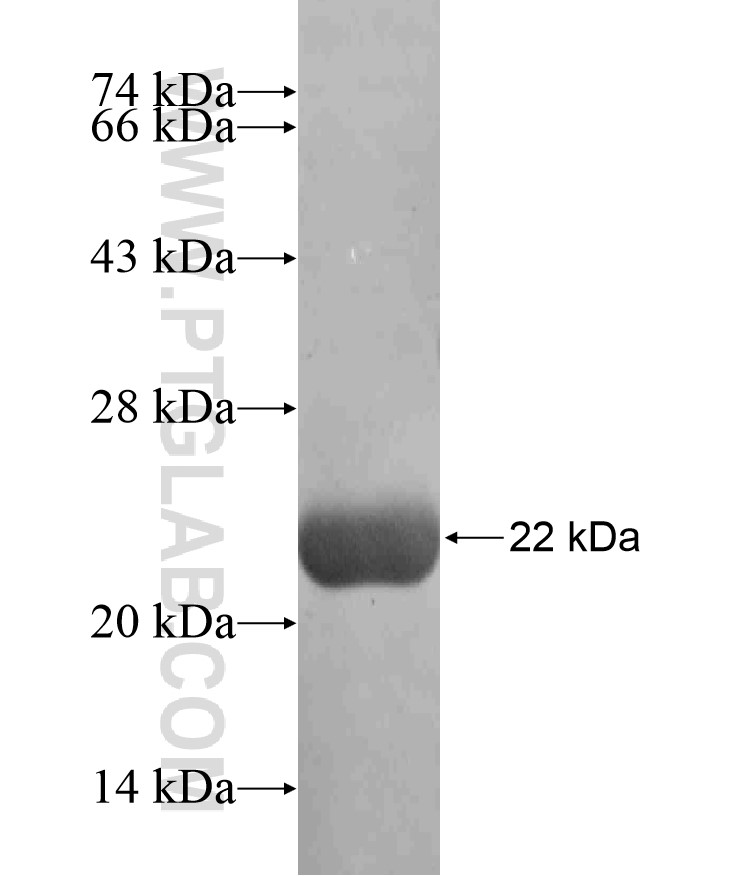 ZNF154 fusion protein Ag17896 SDS-PAGE