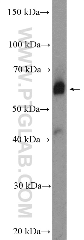 WB analysis of mouse small intestine using 26344-1-AP