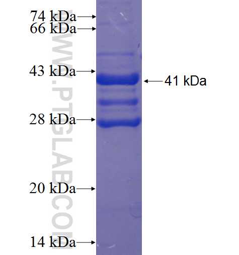 ZNF169 fusion protein Ag23805 SDS-PAGE