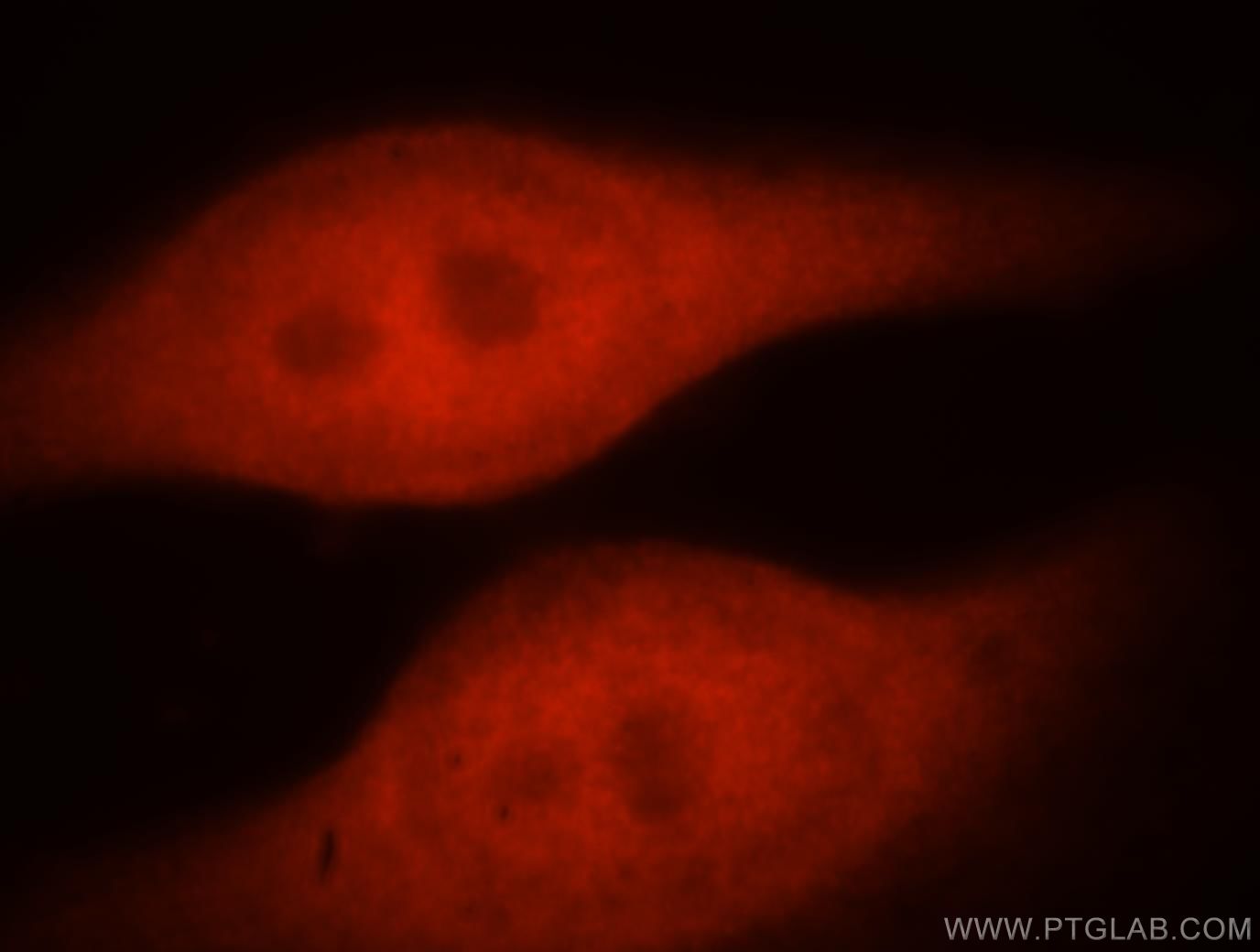 IF Staining of HeLa using 18157-1-AP