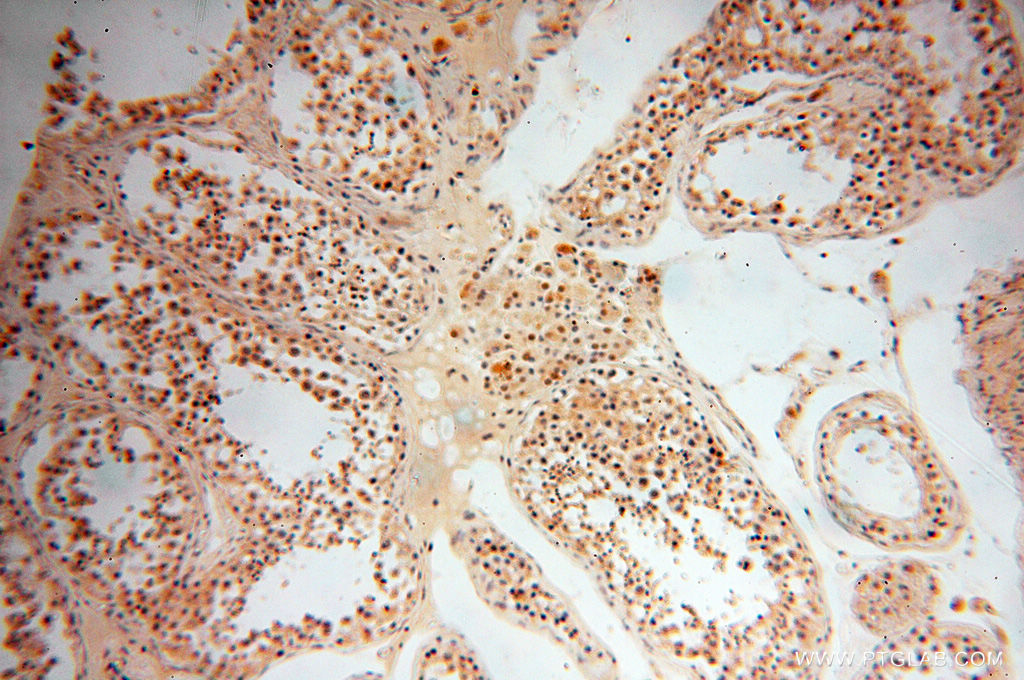 IHC staining of human testis using 18157-1-AP