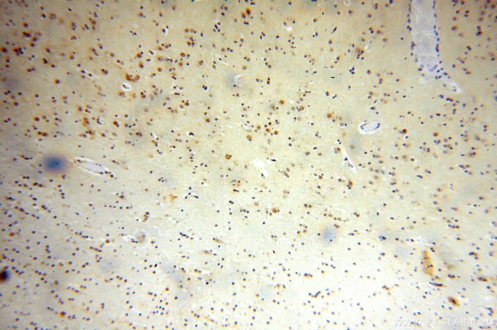 IHC staining of human brain using 17070-1-AP