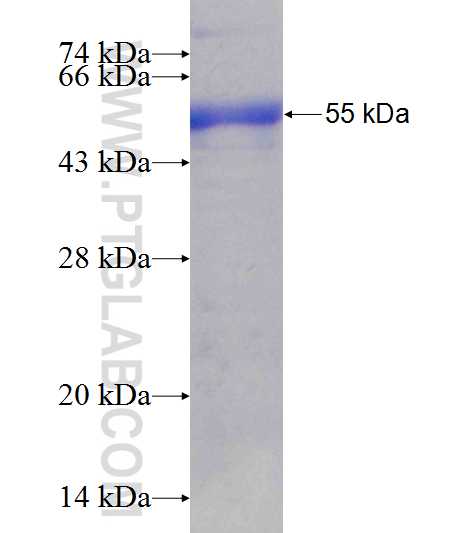 ZNF180 fusion protein Ag25001 SDS-PAGE