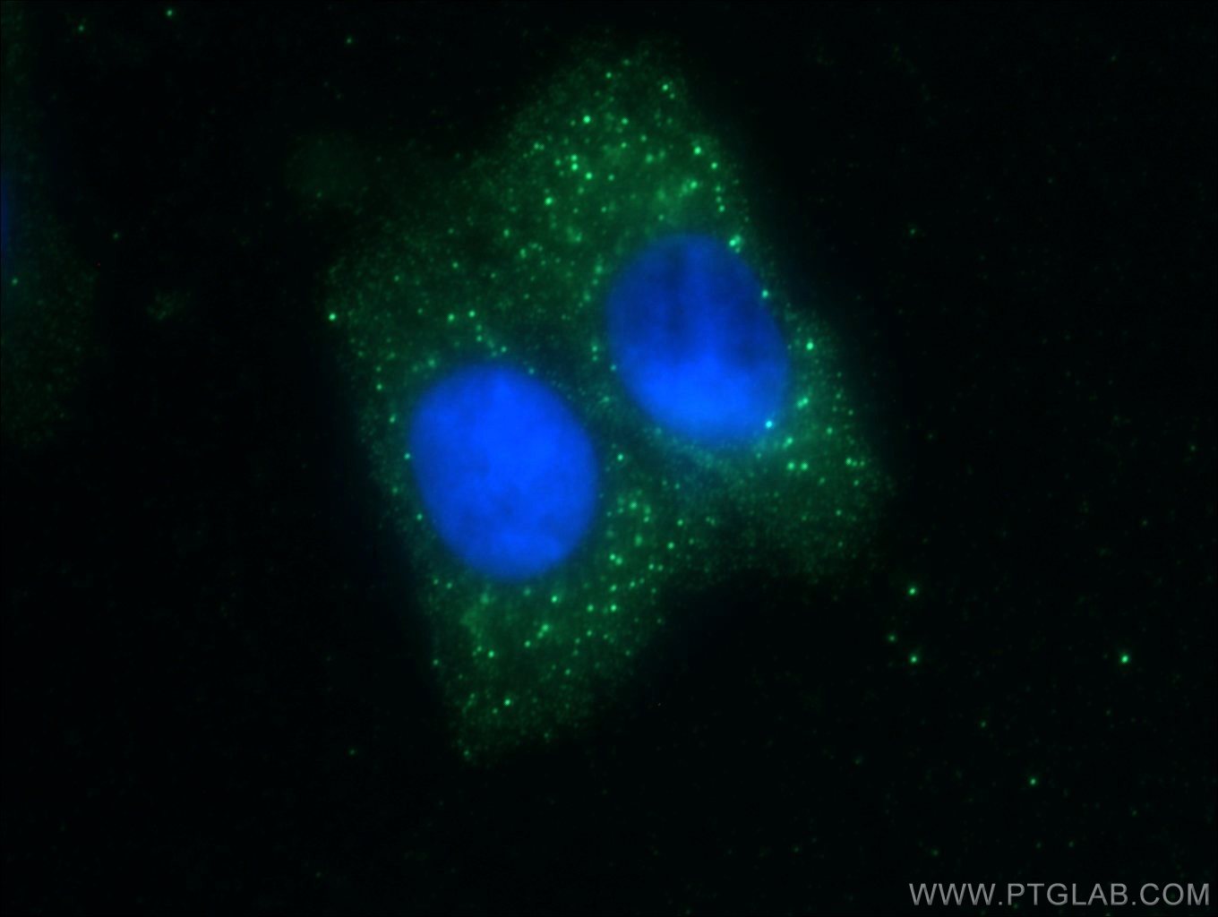 IF Staining of HepG2 using 26100-1-AP