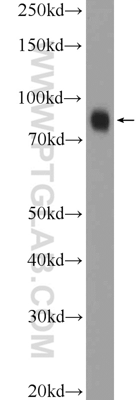 WB analysis of HepG2 using 26100-1-AP