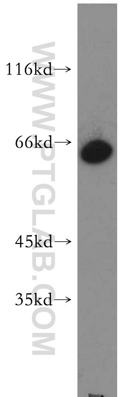 WB analysis of HepG2 using 21656-1-AP