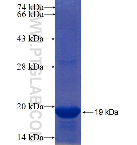 ZNF193 fusion protein Ag22395 SDS-PAGE