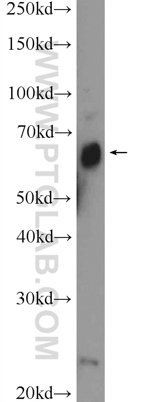 WB analysis of fetal human brain using 24861-1-AP