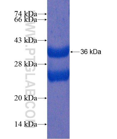 ZNF195 fusion protein Ag21735 SDS-PAGE