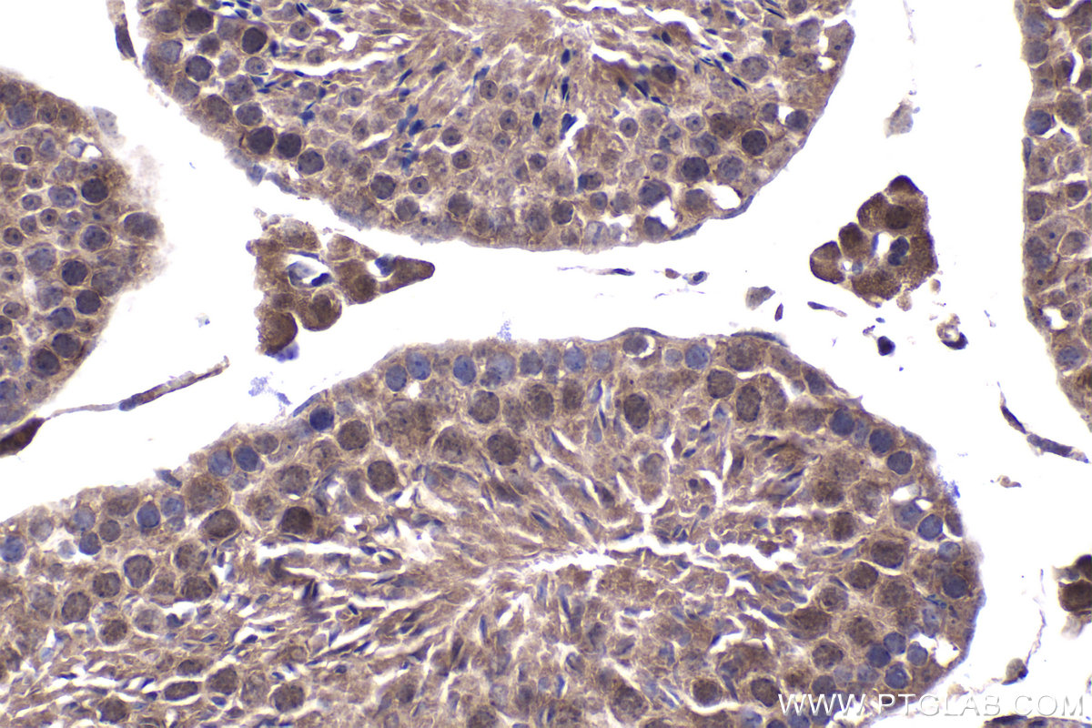 IHC staining of mouse testis using 26216-1-AP