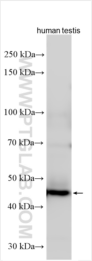 WB analysis using 26216-1-AP