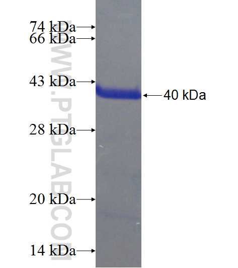 ZNF202 fusion protein Ag23851 SDS-PAGE