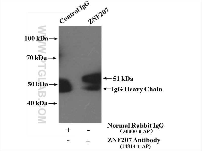 IP experiment of HepG2 using 14814-1-AP