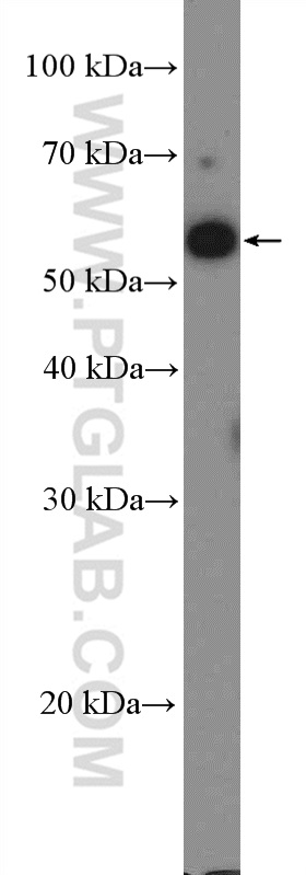 WB analysis of HepG2 using 14814-1-AP