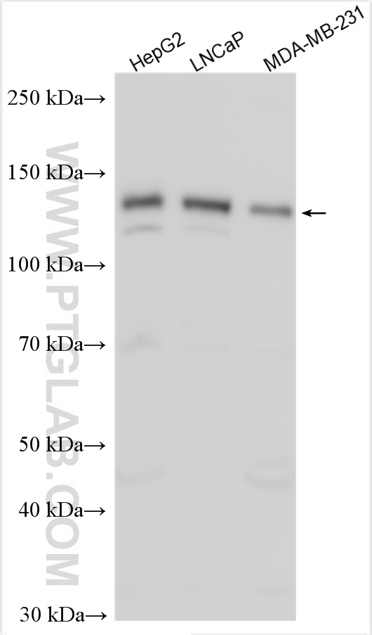 ZNF217