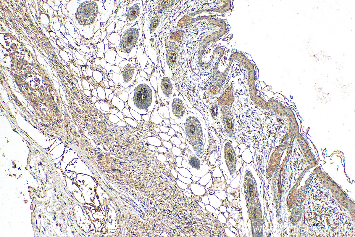 IHC staining of mouse skin using 67730-1-Ig